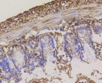 Immunohistochemistry-Paraffin: Hexokinase 1 Antibody (ST47-05) [NBP2-67503] - Analysis of paraffin-embedded mouse colon tissue using anti-Hexokinase 1 antibody. Counter stained with hematoxylin.