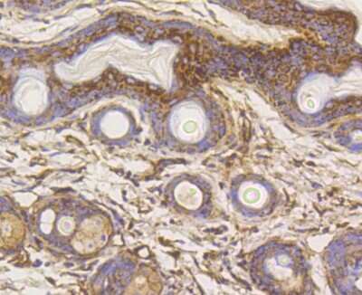 Immunohistochemistry-Paraffin: Hexokinase 1 Antibody (ST47-05) [NBP2-67503] - Analysis of paraffin-embedded mouse skin tissue using anti-Hexokinase 1 antibody. Counter stained with hematoxylin.