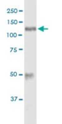 Western Blot: Hexokinase 1 Antibody [H00003098-B01P] - HK1 transfected lysate using anti-HK1 mouse polyclonal antibody and Protein A Magnetic Bead, and immunoblotted with HK1 purified rabbit polyclonal antibody (D01P).