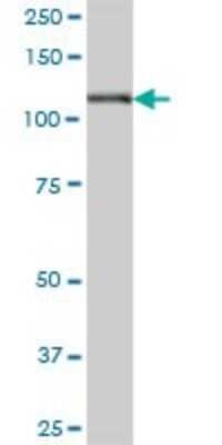 Western Blot: Hexokinase 1 Antibody [H00003098-B01P] - Analysis of HK1 expression in human spleen.