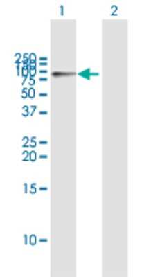 Western Blot: Hexokinase 1 Antibody [H00003098-B01P] - Analysis of HK1 expression in transfected 293T cell line by HK1 polyclonal antibody.  Lane1:HK1 transfected lysate(100.76 KDa). Lane2:Non-transfected lysate.