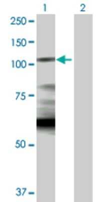 Western Blot: Hexokinase 1 Antibody [H00003098-D01P] - Western Blot analysis of HK1 expression in transfected 293T cell line by HK1 MaxPab rabbit polyclonal antibody. Lane 1: HK1 transfected lysate (102.20 KDa). Lane 2: Non-transfected lysate.