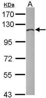 Western Blot: Hexokinase 1 Antibody [NBP1-31600] - Sample (30 ug of whole cell lysate)C: zebrafish muscle7.5% SDS PAGEdiluted at 1:1000