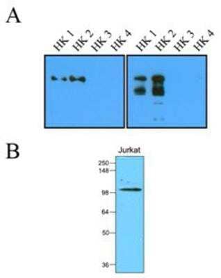 Western Blot: Hexokinase 2 Antibody (1A7) [NBP1-04296] - A): Recombinant protein (20ng or 100ng) of Hexokinase four isoform were resolved by SDS-PAGE, transferred to NC membrane and probed with anti-human Hexokinase I, II (1:1000). (B): Cell lysates of Jurkat (35ug) were resolved by SDS-PAGE, transferred to NC membrane and probed with anti-human Hexokinase I, II (1:2,000). Proteins were visualized using a goat anti-mouse secondary antibody conjugated to HRP and an ECL detection.