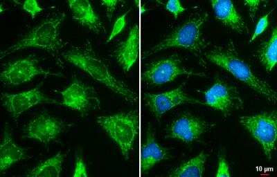 Immunocytochemistry/Immunofluorescence: Hexokinase 2 Antibody [NBP2-16814] -  HeLa cells were fixed in ice-cold MeOH for 5 min. Green: Hexokinase II stained by Hexokinase II antibody diluted at 1:2000. Blue: Fluoroshield with DAPI. Scale bar= 10 um.