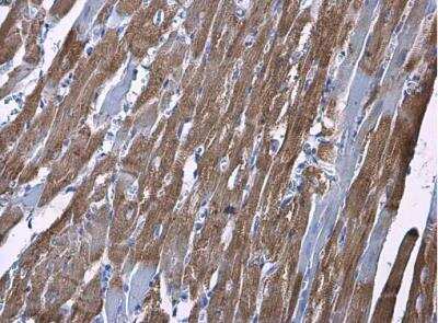 Immunohistochemistry-Paraffin: Hexokinase 2 Antibody [NBP2-16814] - Rat heart. Hexokinase II antibody diluted at 1:500. Antigen Retrieval: Citrate buffer, pH 6.0, 15 min.