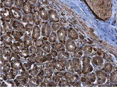 Immunohistochemistry-Paraffin: Hexokinase 2 Antibody [NBP2-16814] - Rat stomach. Hexokinase II antibody diluted at 1:500. Antigen Retrieval: Citrate buffer, pH 6.0, 15 min.