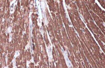 Immunohistochemistry-Paraffin: Hexokinase 2 Antibody [NBP2-16814] - Mouse heart. Hexokinase II stained by Hexokinase II antibody diluted at 1:2000.Antigen Retrieval: Citrate buffer, pH 6.0, 15 min.