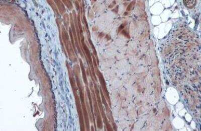 Immunohistochemistry-Paraffin: Hexokinase 2 Antibody [NBP2-16814] - Rat muscle. Hexokinase II stained by Hexokinase II antibody diluted at 1:1000.Antigen Retrieval: Citrate buffer, pH 6.0, 15 min.