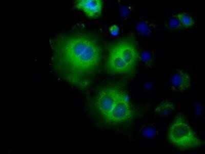 Immunocytochemistry/Immunofluorescence: Hexokinase 2 Antibody (OTI4C5) - Azide and BSA Free [NBP2-70891] - Staining of COS7 cells transiently transfected by pCMV6-ENTRY Hexokinase 2.