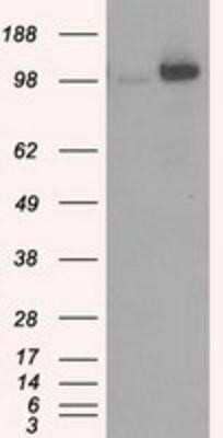 Western Blot: Hexokinase 2 Antibody (OTI4C5) - Azide and BSA Free [NBP2-70891] - HEK293T cells were transfected with the pCMV6-ENTRY control (Left lane) or pCMV6-ENTRY Hexokinase 2 (Right lane) cDNA for 48 hrs and lysed. Equivalent amounts of cell lysates (5 ug per lane) were separated by SDS-PAGE and immunoblotted with anti-Hexokinas