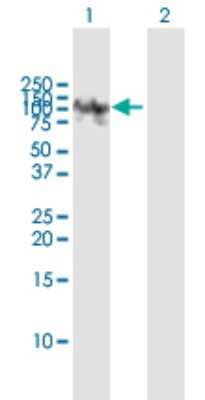 Western Blot: Hexokinase 2 Antibody [H00003099-B01P] - Analysis of HK2 expression in transfected 293T cell line by HK2 polyclonal antibody.  Lane 1: HK2 transfected lysate(100.87 KDa). Lane 2: Non-transfected lysate.