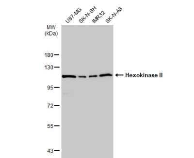 Western Blot: Hexokinase 2 Antibody [NBP2-16814] - Various whole cell extracts (30 ug) were separated by 7.5% SDS-PAGE, and the membrane was blotted with Hexokinase II antibody  diluted at 1:10000. The HRP-conjugated anti-rabbit IgG antibody (NBP2-19301) was used to detect the primary antibody.