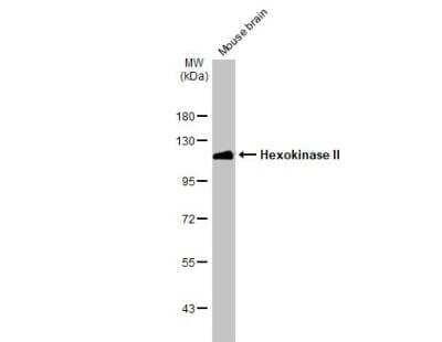 Western Blot: Hexokinase 2 Antibody [NBP2-16814] - Mouse tissue extract (50 ug) was separated by 7.5% SDS-PAGE, and the membrane was blotted with Hk2 antibody diluted at 1:10000. The HRP-conjugated anti-rabbit IgG antibody (NBP2-19301) was used to detect the primary antibody.