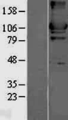 Western Blot: Hexokinase II Overexpression Lysate (Adult Normal) [NBL1-11579] Left-Empty vector transfected control cell lysate (HEK293 cell lysate); Right -Over-expression Lysate for Hexokinase II.