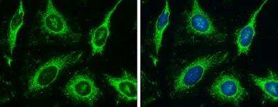 Immunocytochemistry/Immunofluorescence: Hexokinase Type III Antibody [NBP2-16816] -  HeLa cells were fixed in ice-cold MeOH for 5 min. Green: Hexokinase III protein stained by Hexokinase III antibody [C1C3-2] diluted at 1:500. Blue: Hoechst 33342 staining.