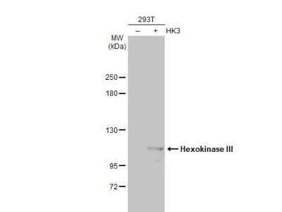 Western Blot: Hexokinase Type III Antibody [NBP2-16816] - Non-transfected (-) and transfected (+) 293T whole cell extracts (30 ug) were separated by 5% SDS-PAGE, and the membrane was blotted with Hexokinase III antibody [C1C3-2] diluted at 1:5000. The HRP-conjugated anti-rabbit IgG antibody (NBP2-19301) was used to detect the primary antibody.