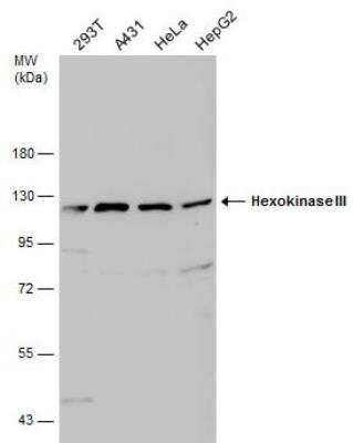 Western Blot: Hexokinase Type III Antibody [NBP2-16816] - Various whole cell extracts (30 ug) were separated by 7.5% SDS-PAGE, and the membrane was blotted with Hexokinase III antibody [C1C3-2]  diluted at 1:1000. The HRP-conjugated anti-rabbit IgG antibody (NBP2-19301) was used to detect the primary antibody.