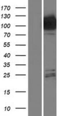 Western Blot Hexokinase Type III Overexpression Lysate