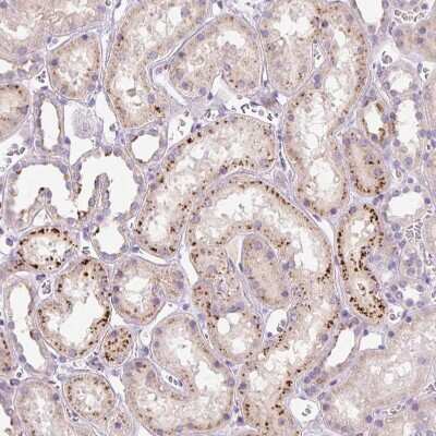 Immunohistochemistry-Paraffin: Hexosaminidase A/HEXA Antibody [NBP2-30997] - Staining of human kidney shows strong granular cytoplasmic positivity in cells in tubules.