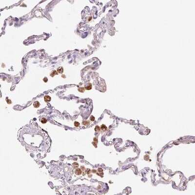Immunohistochemistry-Paraffin: Hexosaminidase A/HEXA Antibody [NBP2-30997] - Staining of human lung shows strong granular cytoplasmic positivity in macrophages.