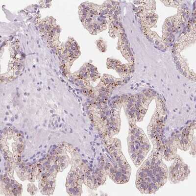 Immunohistochemistry-Paraffin: Hexosaminidase A/HEXA Antibody [NBP2-30997] - Staining of human prostate shows moderate granular cytoplasmic positivity in glandular cells.