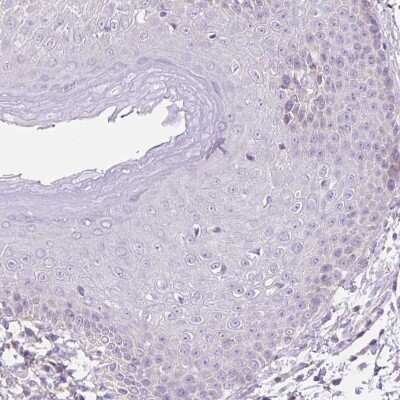 Immunohistochemistry-Paraffin: Hexosaminidase A/HEXA Antibody [NBP2-30997] - Staining of human skin shows no positivity in squamous epithelial cells as expected.