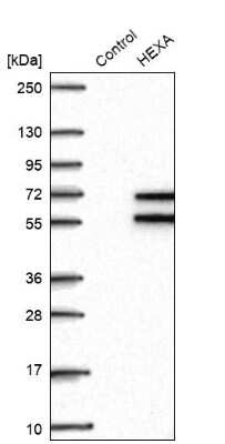 Western Blot: Hexosaminidase A/HEXA Antibody [NBP2-30997] - Analysis in control (vector only transfected HEK293T lysate) and HEXA over-expression lysate (Co-expressed with a C-terminal myc-DDK tag (3.1 kDa) in mammalian HEK293T cells).