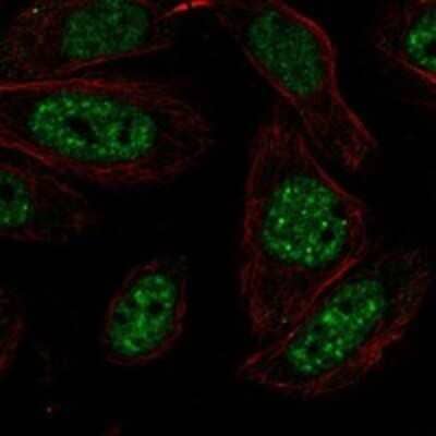 Immunocytochemistry/Immunofluorescence: Hikeshi Antibody [NBP3-17259] - Staining of human cell line SiHa shows localization to nucleoplasm, nuclear speckles & nuclear bodies.
