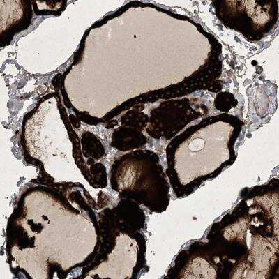 Immunohistochemistry: Hikeshi Antibody [NBP2-33986] - Staining of human thyroid gland shows strong cytoplasmic positivity in glandular cells.