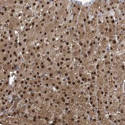 Immunohistochemistry-Paraffin: Hikeshi Antibody [NBP1-83174] - Staining of human liver shows strong nuclear and cytoplasmic positivity in hepatocytes.
