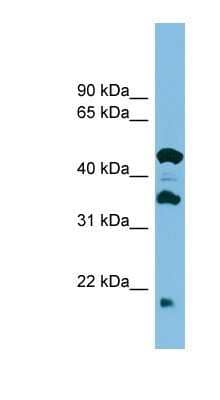 Western Blot: Hikeshi Antibody [NBP1-57764] - ACHN cell lysate, concentration 0.2-1 ug/ml.