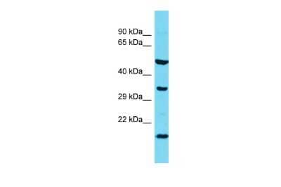 Western Blot: Hikeshi Antibody [NBP2-87566] - Host: Rabbit. Target Name: l7Rn6. Sample Type: Rat Spleen lysates. Antibody Dilution: 1.0ug/ml