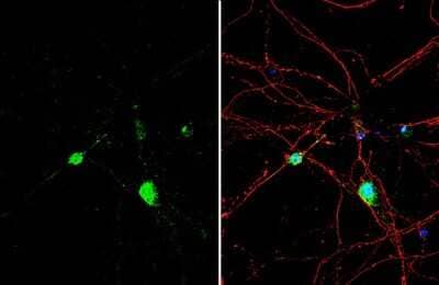 Immunocytochemistry/ Immunofluorescence Histamine Antibody
