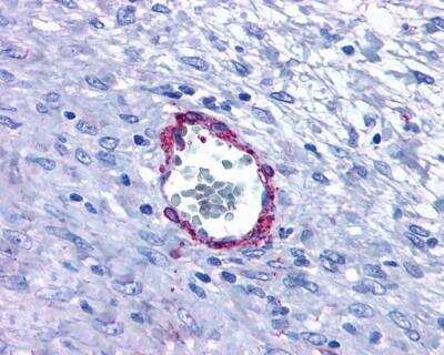 Immunohistochemistry: Histamine H1 R Antibody [NLS1167] - Immunohistochemistry of formalin-fixed, paraffin-embedded tissue after heat-induced antigen retrieval.