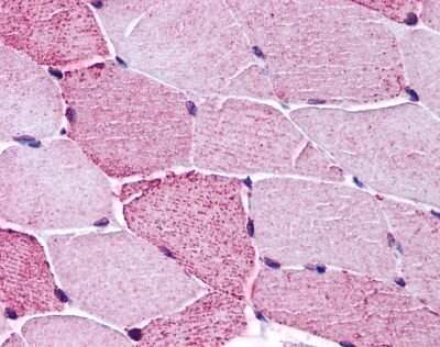 Immunohistochemistry-Paraffin: Histamine H1 R Antibody [NLS1167] - Analysis of anti-HRH1 / Histamine H1 Receptor antibody with skeletal muscle, myocytes.