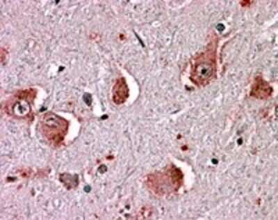 Immunohistochemistry-Paraffin: Histamine H1 R Antibody [NLS1167] - Analysis of anti-HRH1 / Histamine H1 Receptor antibody with brain (neurons and glia) at 11 ug/ ml.