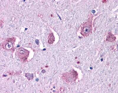 Immunohistochemistry-Paraffin: Histamine H1 R Antibody [NLS1167] - Analysis of anti-HRH1 / Histamine H1 Receptor antibody with human brain, neurons and glia.