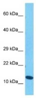 Western Blot: Histone 3 H2a Antibody [NBP3-10092] - Western blot analysis of Histone 3 H2a in Human Jurkat Whole Cell lysates. Antibody dilution at 1ug/ml