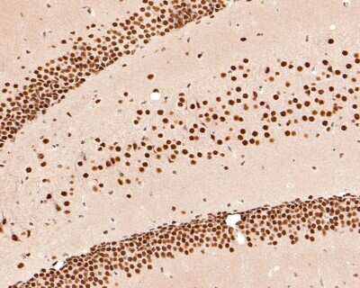 Immunohistochemistry-Paraffin: Histone Deacetylase 2/HDAC2 Antibody (SD0816) [NBP2-67781] - Analysis of paraffin-embedded mouse hippocampus tissue with Rabbit anti-Deacetylase 2/HDAC2 antibody washed with ddH2O and PBS, and then probed with the primary antibody at 1/400 dilution for 1 hour at room temperature. The detection was performed using an HRP conjugated compact polymer system. DAB was used as the chromogen. Tissues were counterstained with hematoxylin and mounted with DPX.