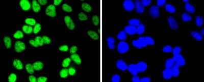Immunocytochemistry/Immunofluorescence: Histone Deacetylase 2/HDAC2 Antibody (SY29-02) [NBP2-67451] - Staining HDAC2 in 293 cells (green). The nuclear counter stain is DAPI (blue). Cells were fixed in paraformaldehyde, permeabilised with 0.25% Triton X100/PBS.