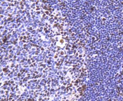 Immunohistochemistry-Paraffin: Histone Deacetylase 2/HDAC2 Antibody (SY29-02) [NBP2-67451] - Analysis of paraffin-embedded human tonsil tissue using anti-HDAC2 antibody. Counter stained with hematoxylin.