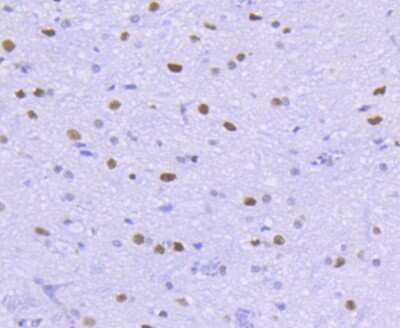 Immunohistochemistry-Paraffin: Histone Deacetylase 2/HDAC2 Antibody (SY29-02) [NBP2-67451] - Analysis of paraffin-embedded rat spinal cord tissue using anti-HDAC2 antibody. Counter stained with hematoxylin.