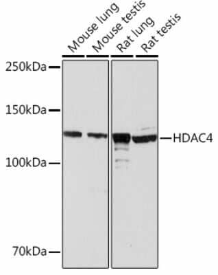 Western Blot: Histone Deacetylase 4/HDAC4 Antibody (9A6E2) [NBP3-15463] - Western blot analysis of extracts of various cell lines, using Histone Deacetylase 4/HDAC4 Rabbit mAb (NBP3-15463) at 1:1000 dilution. Secondary antibody: HRP Goat Anti-Rabbit IgG (H+L) at 1:10000 dilution. Lysates/proteins: 25ug per lane. Blocking buffer: 3% nonfat dry milk in TBST. Detection: ECL Basic Kit. Exposure time: 3min.