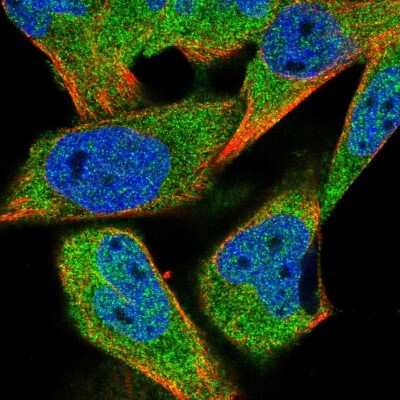 Immunocytochemistry/Immunofluorescence: Histone Deacetylase 4/HDAC4 Antibody [NBP2-58297] - Staining of human cell line RH-30 shows localization to nucleoplasm & cytosol.