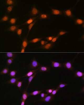 Immunocytochemistry/Immunofluorescence: Histone Deacetylase 8/HDAC8 Antibody (1O2Y5) [NBP3-16713] - Immunofluorescence analysis of NIH-3T3 cells using Histone Deacetylase 8/HDAC8 Rabbit mAb (NBP3-16713) at dilution of 1:100 (40x lens). Blue: DAPI for nuclear staining.