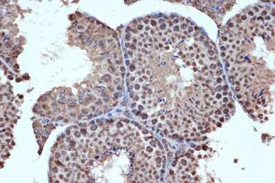 Immunohistochemistry-Paraffin: Histone Deacetylase 8/HDAC8 Antibody (1O2Y5) [NBP3-16713] - Mouse testis using Histone Deacetylase 8/HDAC8 Rabbit mAb (NBP3-16713) at dilution of 1:100 (40x lens).Perform microwave antigen retrieval with 10 mM Tris/EDTA buffer pH 9.0 before commencing with IHC staining protocol.