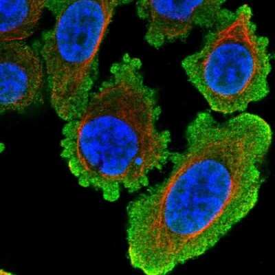 <b>Orthogonal Strategies Validation. </b>Immunocytochemistry/Immunofluorescence: Histone Deacetylase 8/HDAC8 Antibody [NBP2-14085] - Staining of human cell line PC-3 shows localization to nucleus & plasma membrane. Antibody staining is shown in green.