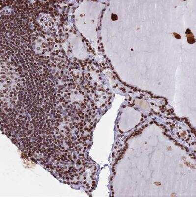 Immunohistochemistry-Paraffin: Histone Deacetylase 8/HDAC8 Antibody [NBP2-14085] - Staining of human thyroid gland shows strong nuclear positivity in glandular cells.