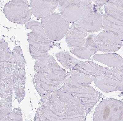 Immunohistochemistry-Paraffin: Histone Deacetylase 8/HDAC8 Antibody [NBP2-14085] - Staining of human skeletal muscle shows no positivity in myocytes.